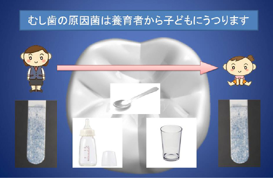 ミュータンス菌が多い方の予防