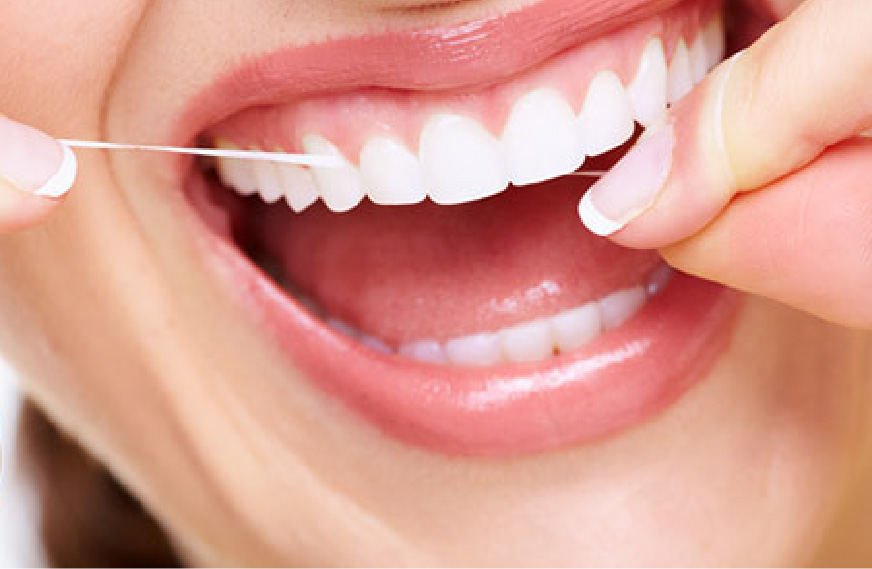 プラークの量が多い方の予防