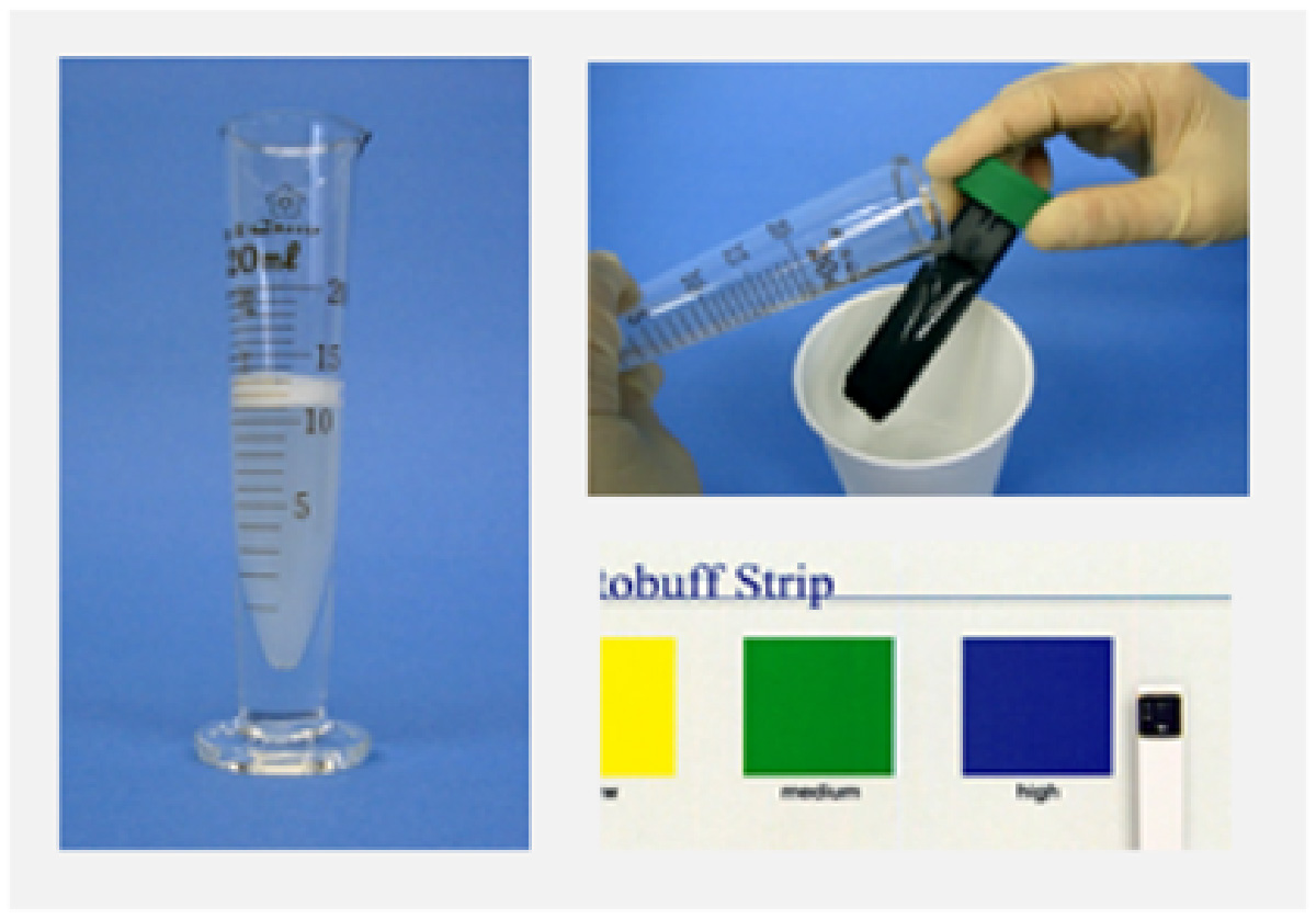 サリバテスト（唾液検査）